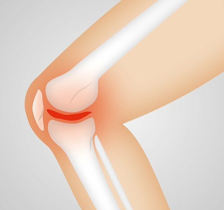 Trattamenti per l’osteoartrosi